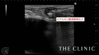 治療法