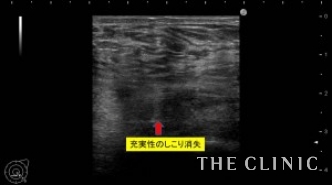 治療法