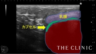 エコー診断