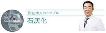 脂肪注入の石灰化