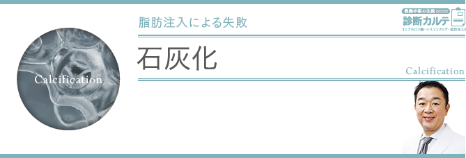 石灰化