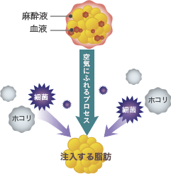 注入する脂肪にホコリや細菌が混入する