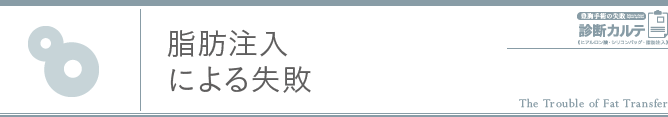 脂肪注入による失敗