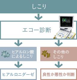 しこり発見から施術までの流れ