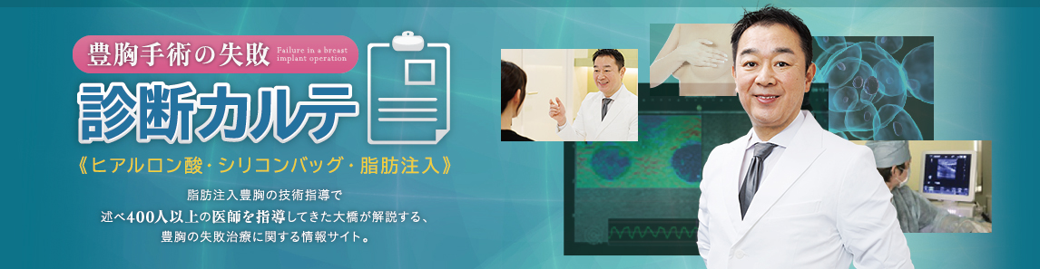 豊胸手術の失敗診断カルテ
