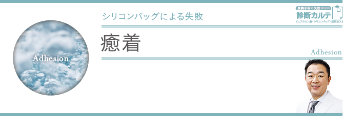 癒着