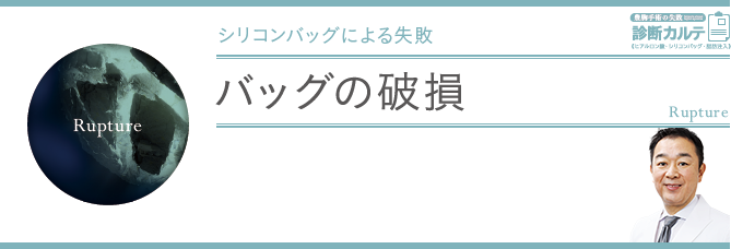 バッグの破損