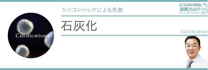 石灰化