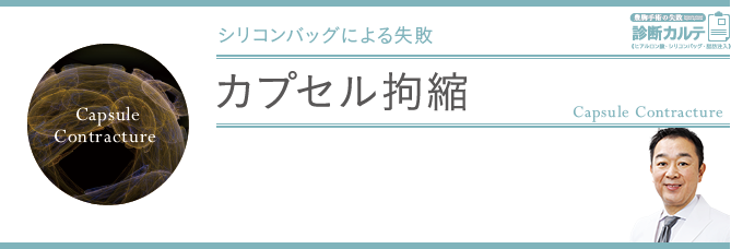カプセル拘縮