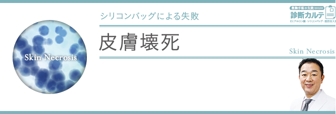 皮膚壊死