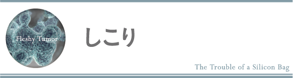 しこり