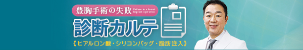 豊胸手術の失敗 診断カルテ