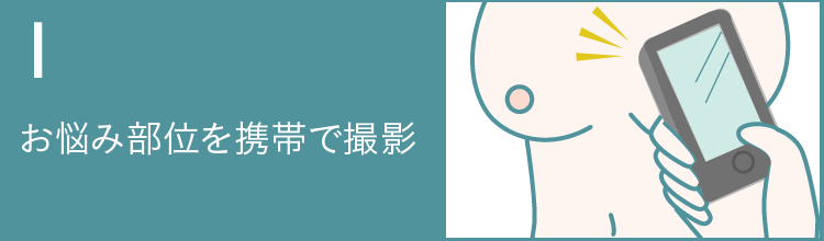 お悩み部位を携帯で撮影