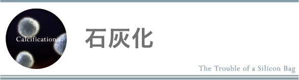 石灰化